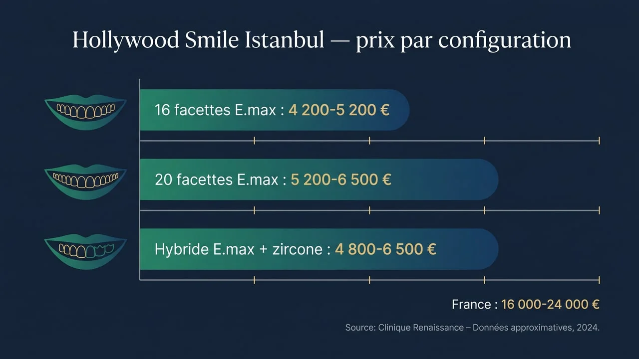 Prix du Hollywood Smile à Istanbul selon la configuration — 16 facettes, 20 facettes, approche hybride