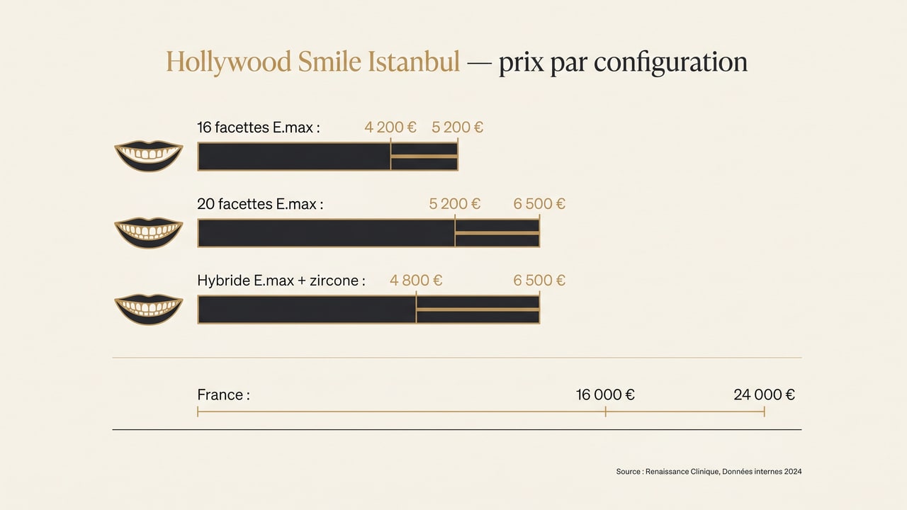 Prix du Hollywood Smile à Istanbul selon la configuration — 16 facettes, 20 facettes, approche hybride