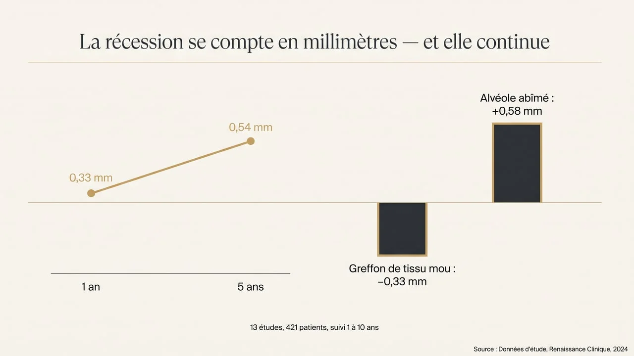Graphique montrant la progression de la récession vestibulaire après implant immédiat et l'effet du greffon de tissu mou et d'un alvéole abîmé