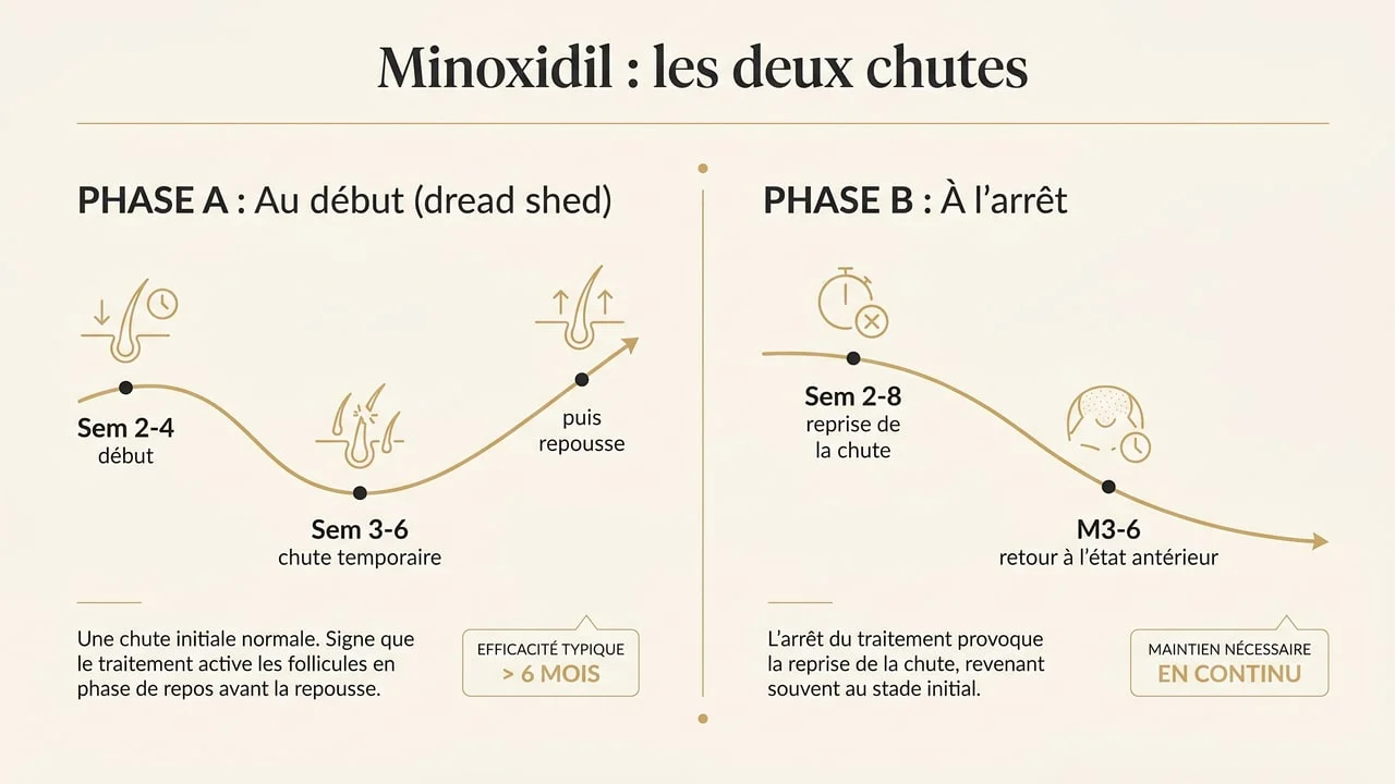 Deux chutes liées au minoxidil : shedding initial au début, perte des gains à l'arrêt