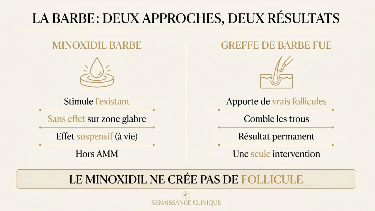 Comparaison infographique du minoxidil et de la greffe de barbe FUE : stimulation temporaire vs implantation permanente de follicules