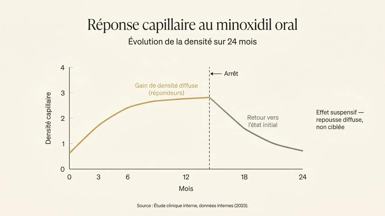 Courbe de la réponse capillaire au minoxidil oral : densification diffuse temporaire puis retour vers l'état initial après l'arrêt