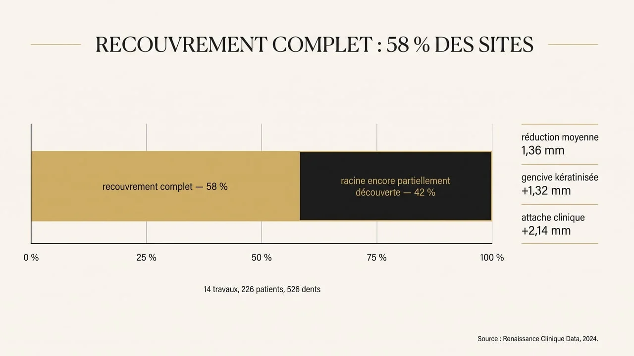 Graphique montrant que le recouvrement radiculaire complet est obtenu dans 58 % des sites traités