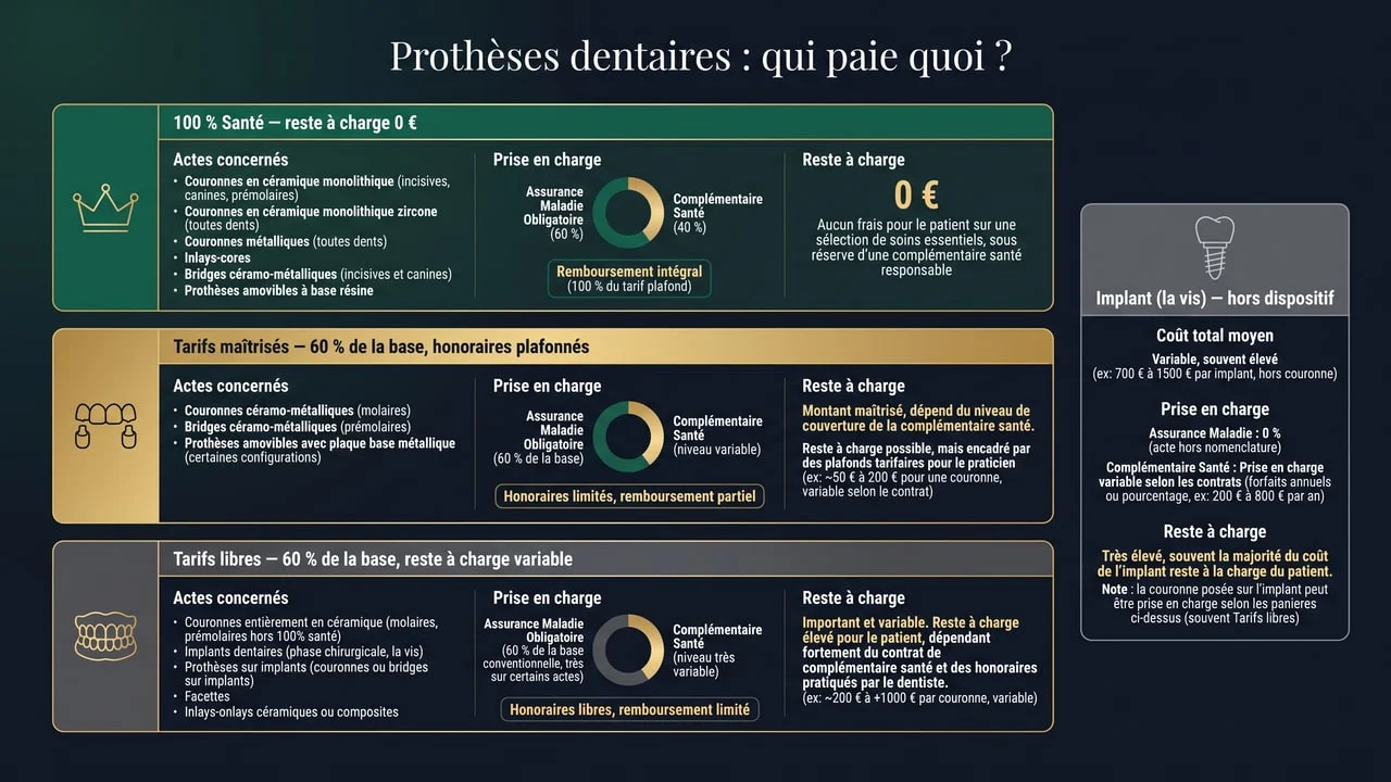 Infographie présentant les trois paniers de prise en charge des prothèses dentaires — 100 % Santé sans reste à charge, tarifs maîtrisés et tarifs libres remboursés à 60 % de la base — et l'implant, exclu du dispositif