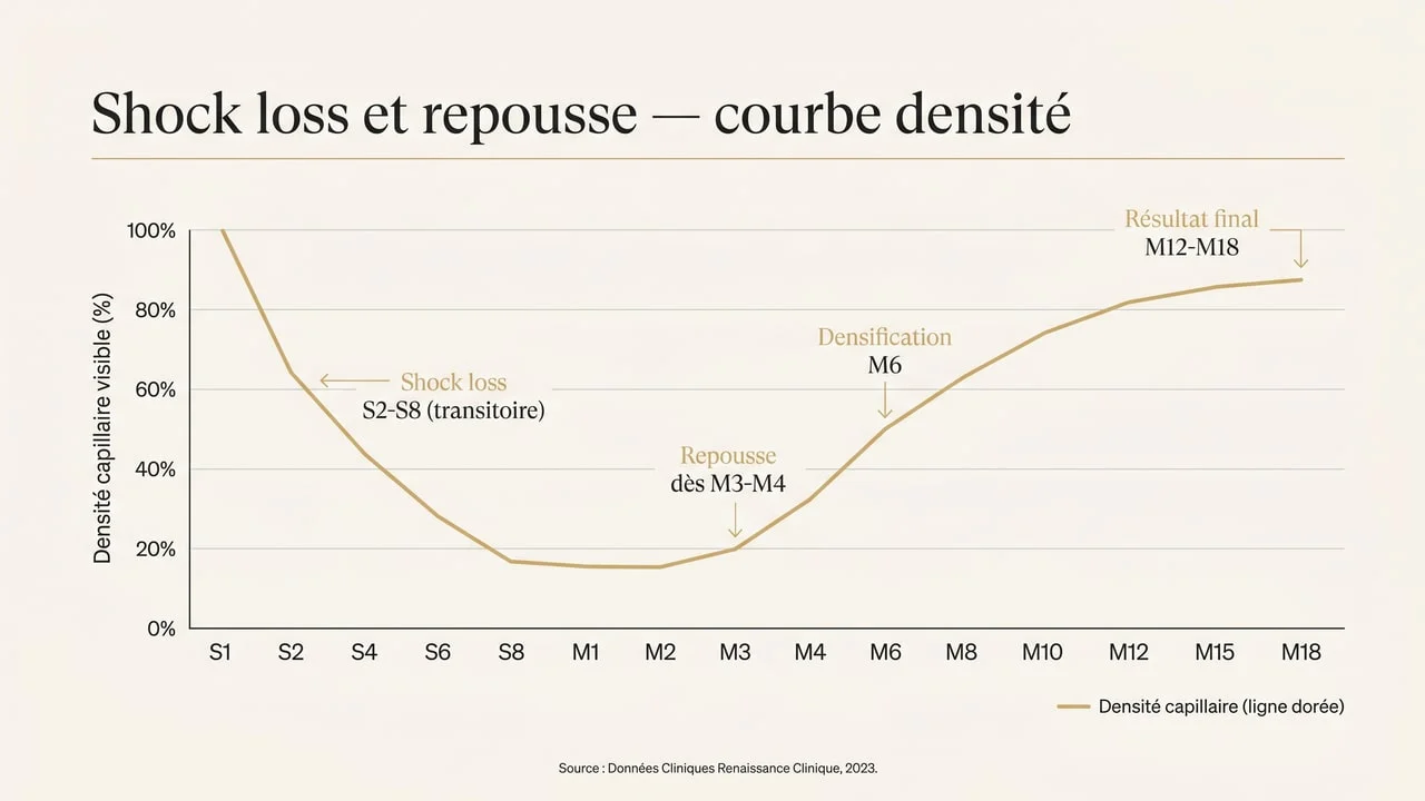 Courbe de densité capillaire après greffe : chute transitoire (shock loss) entre la 2e et la 8e semaine puis repousse progressive de M3 à M18